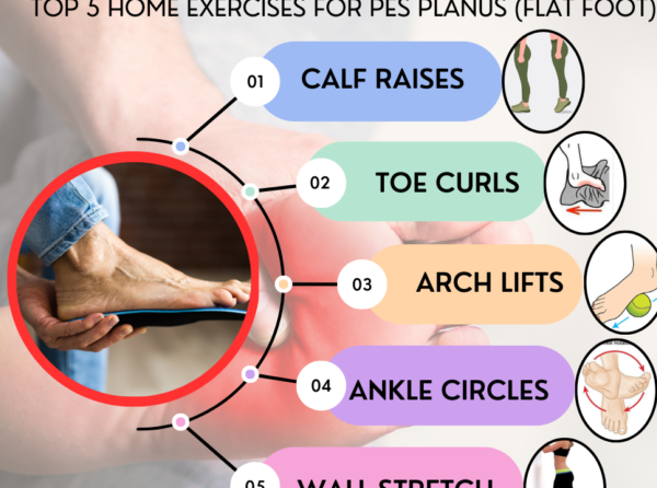 Exercises for Flat Feet: Innovative Orthotic Solutions and Strengthening Routines