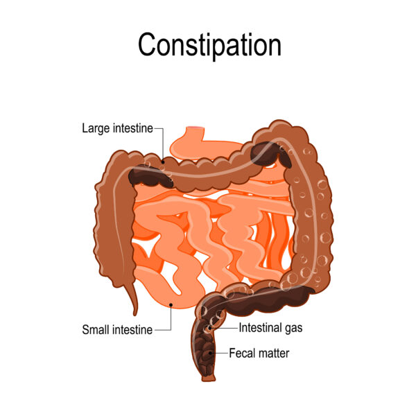 Gut Relief: Discovering the Power of Probiotics Against Constipation