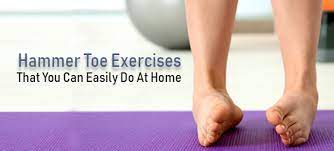 Unlock Effective Exercises and Footwear Tips for Hammertoe Relief