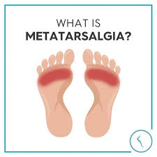 Metatarsalgia Mastery: Revolutionary Relief, Soothing Solutions & Expert Advice