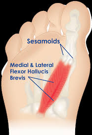 Conquer Sesamoiditis: Revolutionary Relief Strategies for Foot Pain